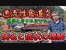 【病名と症状の理解】逆流性食道炎と脅されました #内海聡 #うつみん 【世界一嫌われ医者】