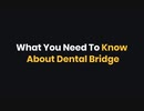 What You Need To Know About Dental Bridges