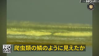 遺体解剖で、深刻な問題を発見