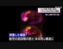 “人工の胚 作成に成功” イギリスの大学などが発表
