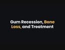 Gum Recession, Bone Loss, and Treatment