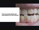 Understanding Dental Occlusion