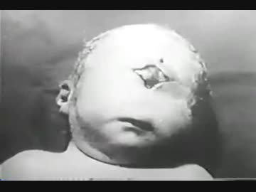 【閲覧注意】ホモと恐怖する 放射能の恐ろしさ