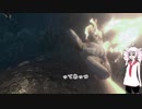 足で歩けpart2「Those Who Remain」　