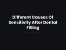 Different Causes Of Sensitivity After Dental Filling How To Manage It