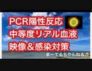 コ○ナから身を守るためにはどうしたらいいか？□入院するレベルの血液映像□酸欠＆血栓過多！