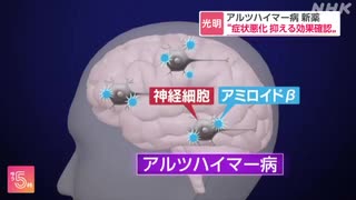 アルツハイマー病の新薬“症状悪化抑える効果確認” エーザイ