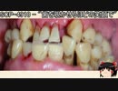 ゆっくりと一緒にSCPを紹介したい！その101【SCP】