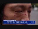 イギリスで中国領事館の職員が香港人に暴行