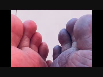 報告は氷山の一角 399