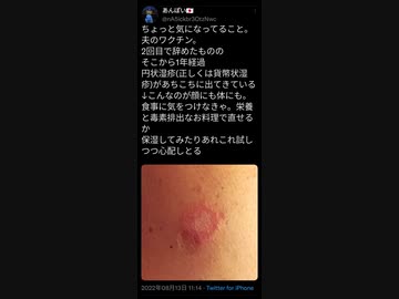 報告は氷山の一角 401