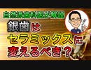 【自然派歯科医が解説】銀歯はセラミックスに変えるべきか #高橋浩司 #虫歯