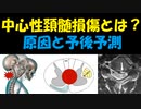 中心性頚髄損傷とは何か、原因と症状と予後予測、手術について解説