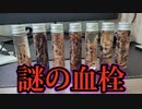 人を死に至らしめる謎の血栓がスパイクタンパク質によるものだと判明。