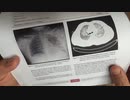 ［再］アレの症例報告論文1