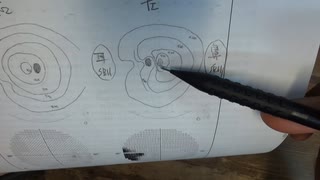 ワクチン後症候群の症例報告論文（室蘭市立総合病院）