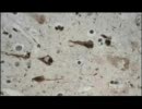 A Fight to the Death (6/6)