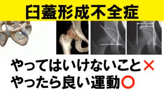 臼蓋形成不全ってどんな病気？やってはいけないことややった方が良い筋力トレーニングについてご紹介