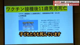 全国有志医師の会、中村医師「多くの子どもたちが★。★まで至らずとも重度の後遺症」