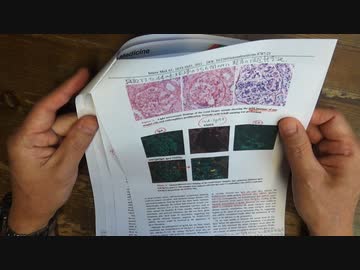 ワクチン後症候群の症例報告論文（順天堂大学）