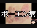 【ゆっくり朗読】ゆっくりさんと不思議な病気 その541