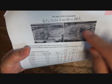 ワクチン後症候群の症例報告論文（国際医療福祉大学）