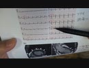 ワクチン後症候群の症例報告論文（東邦大学）