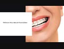 Things You Must Consider Before Having A Dental Braces