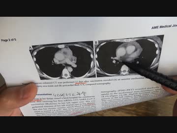 ワクチン後症候群の症例報告論文（高崎総合医療センター）