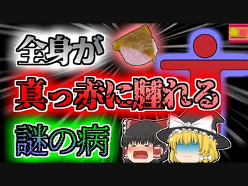 【2007年岐阜】和菓子を食べて体が真っ赤に変色⁉謎の奇病に苦しんだOL『コチニールアレルギー』【ゆっくり解説】
