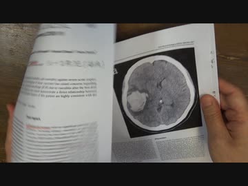 ワクチン後症候群の症例報告論文（白十字病院）