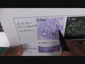 ワクチン後症候群の症例報告論文（磐田市立総合病院）
