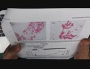 ワクチン後症候群の症例報告論文（和歌山県立医科大学５）