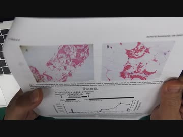 ワクチン後症候群の症例報告論文（和歌山県立医科大学５）