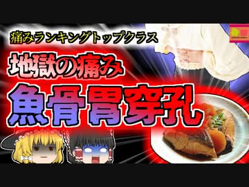 【2016年東京】 大好きなあの和食で胃に穴が？人間が感じる痛みの中でもトップクラスに辛い症状 『魚骨胃壁穿孔事故』【ゆっくり解説】