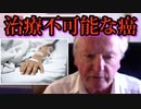 【Angus Dalglesh】アンガス・ダルグリーシュ博士「ワクチンによって発生した癌は治療不可能だ。」