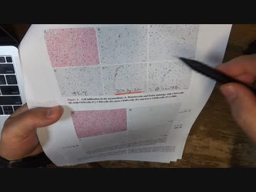 ワクチン後症候群の症例報告論文（長崎大学３）