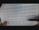 ワクチン後症候群の症例報告論文（東近江総合医療センター）