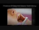 Dentist Teeth Removal