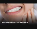HOW CAN BRUXISM AFFECT YOUR DENTAL HEALTH
