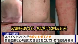 高知大学大学の佐野教授「ワクチン打ってる人の方が逆にコロナに罹りやすい」