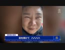 中国のコロナ？後遺症 　顔面の麻痺やむくみ、女性にヒゲ