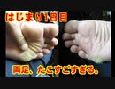 はじまり1日目：両足、たこすごすぎる。help me Japan　Please subscribe to our channel.