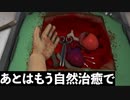 誰でもヤブ医者になれるヤバいゲーム【surgeon simulator】