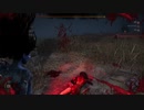 仲間が負傷すると楽しくなるDBD2【Dead by Daylight】