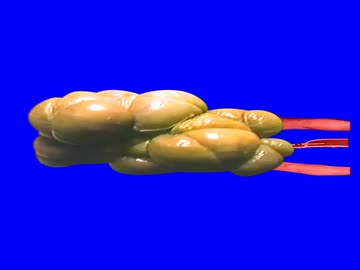 エレブリャーBB
