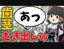 味方のキルジョイさん歯茎むき出しｗ【VALORANTゆっくり実況】