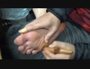 右足たこ、自分で治療【82日目】マッサージ棒を使ってみます　help me Japan