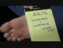 右足たこ、自分で治療【183日目】help me Japan　Please subscribe to our channel.