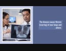 What are symptoms of asbestos exposure - (Asbestos Testing and Inspection Rockville MD)